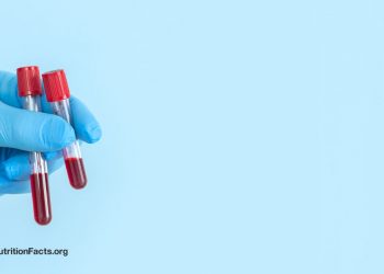 So behandeln Sie einen hohen Lp(a)-Wert, einen Risikofaktor für Arteriosklerose