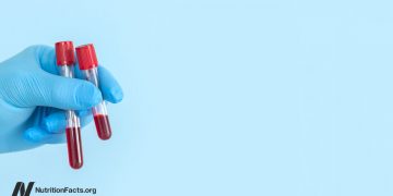 So behandeln Sie einen hohen Lp(a)-Wert, einen Risikofaktor für Arteriosklerose