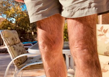 Hilft eine Kollagenergänzung bei Kniearthritis?