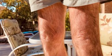 Hilft eine Kollagenergänzung bei Kniearthritis?