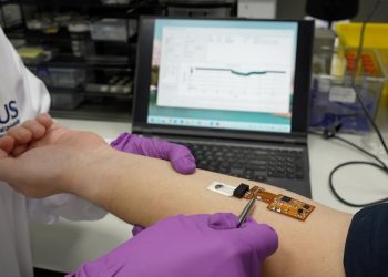 Neuester tragbarer Sensor in Singapur erfasst Diabetes und Schlaganfall
