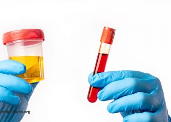 Take a look at auf Vitamin-B12-Mangel