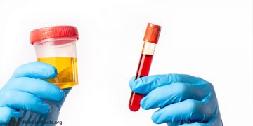 Take a look at auf Vitamin-B12-Mangel