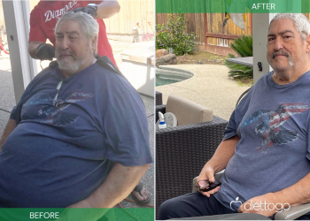 Mann nimmt mit einer Diät vor einer Hüftoperation über 45 Kilo ab