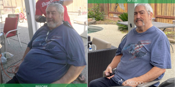 Mann nimmt mit einer Diät vor einer Hüftoperation über 45 Kilo ab