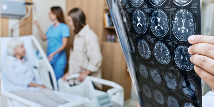 Ein Leitfaden für die Zeitplanung bei der Genesung nach einem Schlaganfall