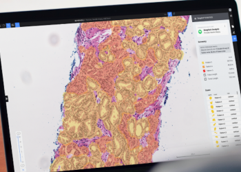 Roche stärkt digitale Pathologie mit KI und mehr Aufträgen