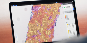 Roche stärkt digitale Pathologie mit KI und mehr Aufträgen