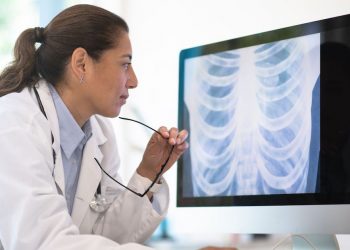 Imidex kooperiert mit Orbit Genomics zur Früherkennung von Lungenkrebs