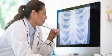 Imidex kooperiert mit Orbit Genomics zur Früherkennung von Lungenkrebs