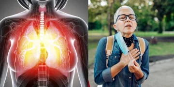 Wie ich nach Jahren des Leidens mit chronischer Bronchitis wieder freier durchatmen kann, obwohl bisher nichts bei mir gewirkt hat!