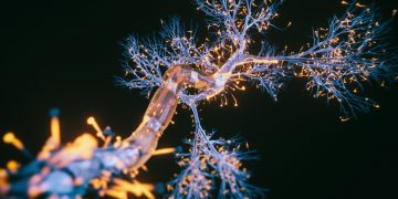 Die Zeitleiste der Alzheimer-Krankheit zeigt, dass neuronale Veränderungen als Rinnsal beginnen und sich zu einem Strom von Schüssen entwickeln
