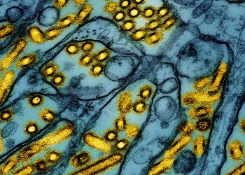 Louisiana-Particular person ist der erste Todesfall durch Vogelgrippe in den USA