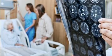 Ein Leitfaden für das, was Sie während der Timeline der Schlaganfallwiederherstellung erwarten können