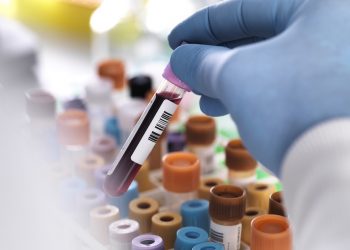 Royal Philips, IBEX Medical Analytics Erweiterungspartnerschaft für Pathologie Diagnostik