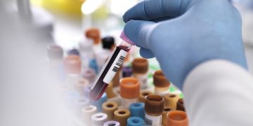 Royal Philips, IBEX Medical Analytics Erweiterungspartnerschaft für Pathologie Diagnostik