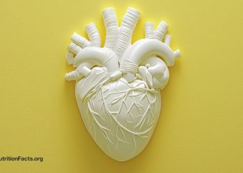 Die Risiken gegen Vorteile von Angioplastie und Herzstents