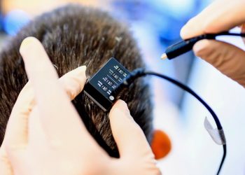 Ein Gehirnimplantat kann Gedanken in Sprache umwandeln