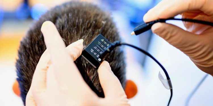 Ein Gehirnimplantat kann Gedanken in Sprache umwandeln