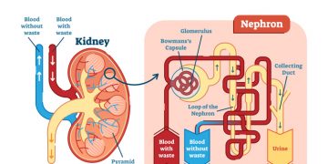 Verwaltung von ADPKD: Ernährungsstrategien für die Nierengesundheit
