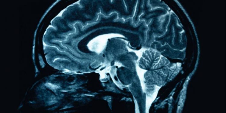 ABC Information berichtet mögliche Betrugsbetrug in der Foundation -Alzheimer -Krankheitsforschung