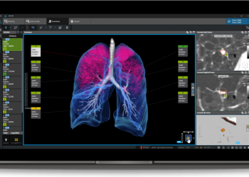 Coreline Smooth tritt in China ein und weitere Slips
