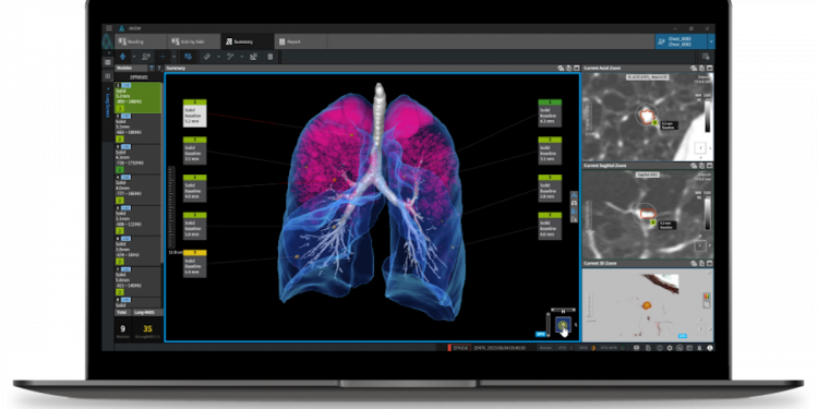 Coreline Smooth tritt in China ein und weitere Slips