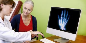 Knochen nach Knochengesundheit