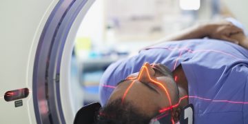 Chipiron sammelt 17 Mio. USD für den Miniatur -MRT -Prototyp