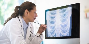 Queensland Analysis entwickeln tragbare Röntgenaufnahmen für Kinder und mehr Briefs