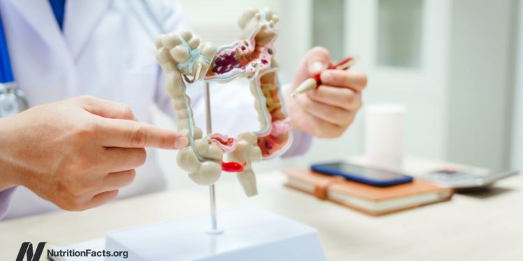 Die Gültigkeit von SIBO -Checks