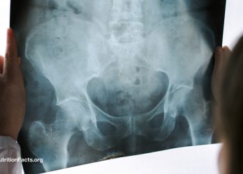 Beckenuntersuchungen von Medizinstudenten an anästhesierten Frauen