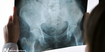 Beckenuntersuchungen von Medizinstudenten an anästhesierten Frauen