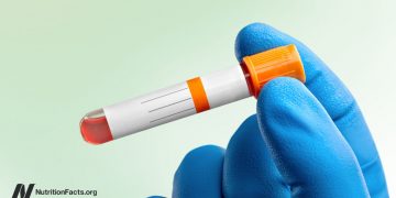 Idealer vs. normaler Cholesterinspiegel