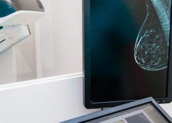 Eine neue Studie stellt die Artwork und Weise, wie wir Brustkrebs erkennen, in Frage