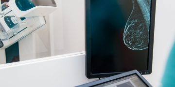 Eine neue Studie stellt die Artwork und Weise, wie wir Brustkrebs erkennen, in Frage