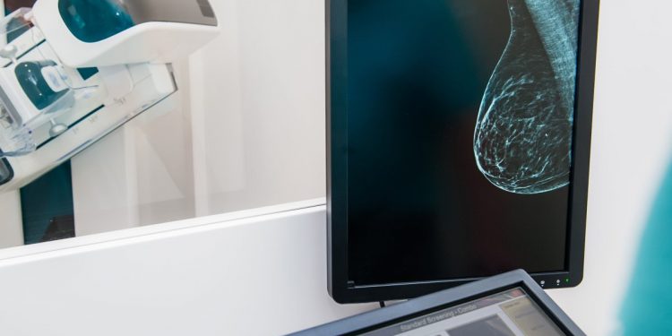 Eine neue Studie stellt die Artwork und Weise, wie wir Brustkrebs erkennen, in Frage