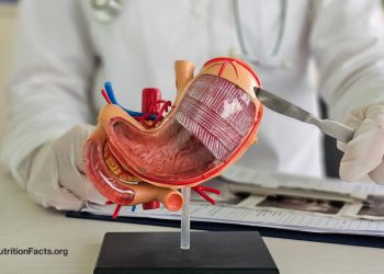 Die versteckten Kosten der bariatrischen Chirurgie