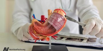 Die versteckten Kosten der bariatrischen Chirurgie