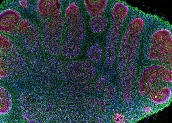 Gehirnorganoide helfen Forschern, werfen aber ethische Fragen auf: Schüsse