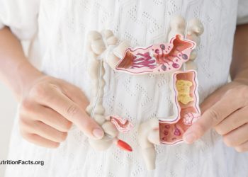 Welche Lebensmittel helfen bei einem durchlässigen Darm?