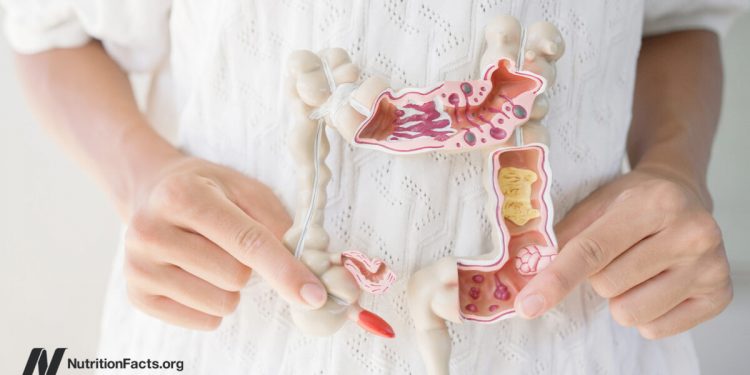 Welche Lebensmittel helfen bei einem durchlässigen Darm?