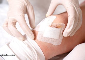 Wenn die Lösung eine Phantasm ist