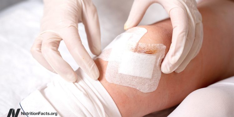 Wenn die Lösung eine Phantasm ist