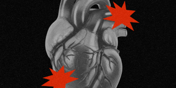 Der neue Weg, Ihr Herzinfarktrisiko vorherzusagen