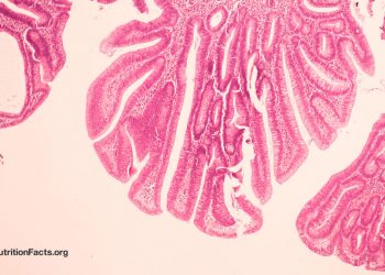 Könnte das Rinderleukämievirus eine Ursache für Brustkrebs sein?