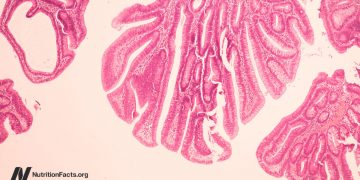 Könnte das Rinderleukämievirus eine Ursache für Brustkrebs sein?