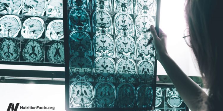 Ein persistentes Pestizid ist mit dem Alzheimer-Risiko verbunden