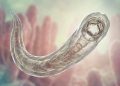 Hakenwurm und Schlaf: Der Zusammenhang zwischen Eisenmangel