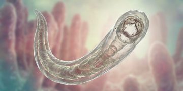 Hakenwurm und Schlaf: Der Zusammenhang zwischen Eisenmangel